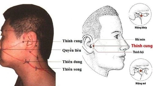 Bấm huyệt chữa ù tai theo Đông y giúp kích thích tuần hoàn, giảm triệu chứng ù tai hiệu quả
