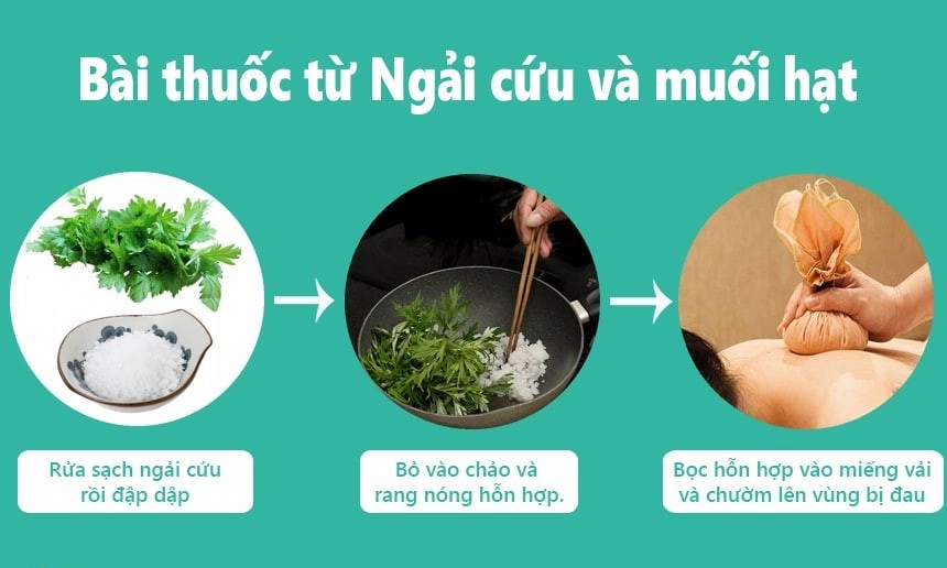 Mẹo chữa đau vai gáy tại nhà.