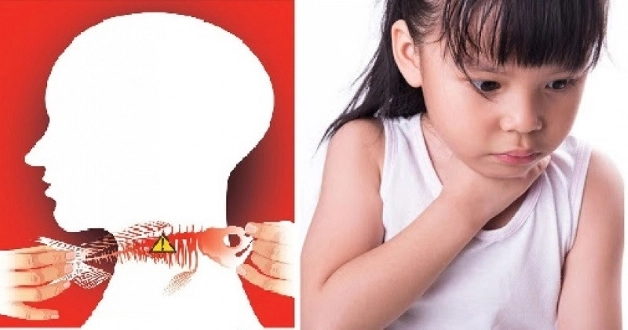 Những điều không nên làm khi áp dụng mẹo vặt trị hóc xương cá.
