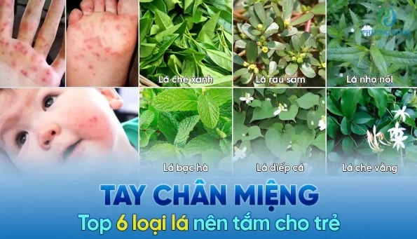 Mẹo dân gian như tắm lá trà xanh, lá mướp đắng,giúp làm dịu da, giảm ngứa cho bé 