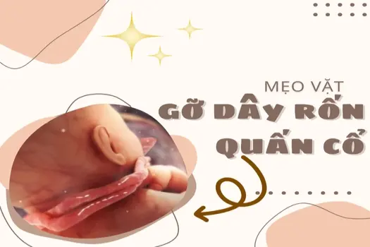 Mẹo chữa dây rốn quấn cổ 1 vòng mẹ bầu an tâm nhé!
