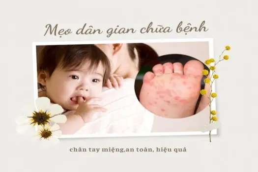 Mẹo dân gian chữa bệnh chân tay miệng,an toàn, hiệu quả