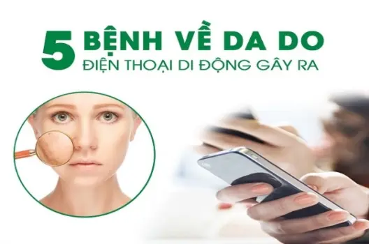 Viêm nhiễm da liễu do điện thoại: cảnh báo vệ sinh bạn cần biết?